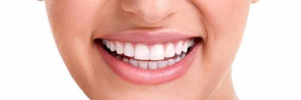 Clareamento dental: o que você precisa saber